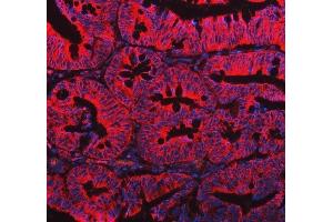 IF analysis of EML4 using anti-EML4 antibody (ABIN6719384).