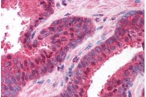 Human Prostate (formalin-fixed, paraffin-embedded) stained with PPP4C antibody ABIN214615 at 10 ug/ml followed by biotinylated goat anti-rabbit IgG secondary antibody ABIN481713, alkaline phosphatase-streptavidin and chromogen. (PPP4C 抗体  (AA 294-307))