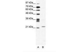 Image no. 1 for anti-Twist Homolog 1 (Drosophila) (TWIST1) (C-Term) antibody (ABIN202060) (TWIST1 抗体  (C-Term))