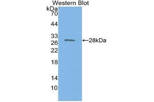 Western Blotting (WB) image for anti-Proteasome 26S Subunit, Non ATPase 9 (AA 2-223) antibody (ABIN1860343) (Proteasome 26S Subunit, Non ATPase 9 (AA 2-223) 抗体)