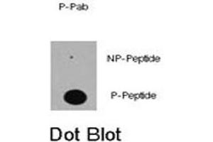 Dot blot analysis of EP300 (phospho S89) polyclonal antibody  on nitrocellulose membrane.