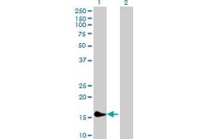 Western Blot analysis of PLA2G16 expression in transfected 293T cell line by PLA2G16 MaxPab polyclonal antibody. (PLA2G16 抗体  (AA 1-162))