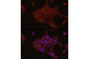 Immunofluorescence (IF) image for anti-Transforming Growth Factor, beta-Induced, 68kDa (TGFBI) (AA 481-683) antibody (ABIN3023373)