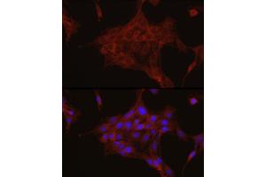 Immunofluorescence analysis of PC-12 cells using TGF beta induced (TGFBI) Rabbit pAb (ABIN3023372, ABIN3023373, ABIN3023374 and ABIN6219663) at dilution of 1:50 (40x lens). (TGFBI 抗体  (AA 481-683))