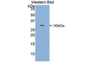 Western Blotting (WB) image for anti-DNA Fragmentation Factor, 40kDa, beta Polypeptide (Caspase-Activated DNase) (DFFB) (AA 87-323) antibody (ABIN3207309) (DFFB 抗体  (AA 87-323))