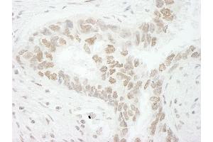 Immunohistochemistry (IHC) image for anti-CD3e Molecule, epsilon Associated Protein (CD3EAP) (AA 404-454) antibody (ABIN7448916) (CD3EAP 抗体  (AA 404-454))