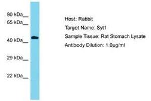 Image no. 1 for anti-Synaptotagmin I (SYT1) (AA 104-153) antibody (ABIN6750420) (SYT1 抗体  (AA 104-153))