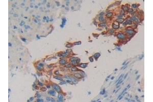 Detection of CK 20 in Human Lung Tissue using Polyclonal Antibody to Cytokeratin 20 (CK 20) (KRT20 抗体  (AA 9-424))