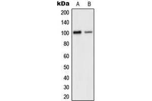 Western blot analysis of GLUR2 expression in human brain (A), mouse cortex (B) whole cell lysates. (GRIA2 抗体  (C-Term))
