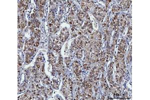 IHC analysis of KMO using anti-KMO antibody (ABIN7600958).