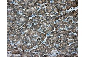 Immunohistochemical staining of paraffin-embedded Kidney tissue using anti-ACSBG1 mouse monoclonal antibody. (ACSBG1 抗体)