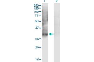 Western Blot analysis of PDX1 expression in transfected 293T cell line by IPF1 monoclonal antibody (M02), clone 4E12. (PDX1 抗体  (AA 109-208))