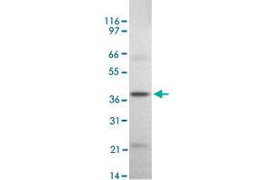 Western blot analysis of DAPK2 in rat kidney tissue lysate using DAPK2 polyclonal antibody  at 2 ug/mL . (DAPK2 抗体  (AA 325-342))