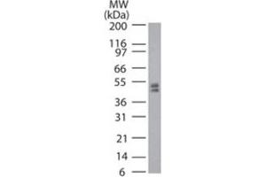 Western blot analysis of Trdmt1 in mouse ES cell lysate using Trdmt1 polyclonal antibody  at 2 ug/mL . (Dnmt2 抗体  (AA 39-53))