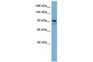 FAM62B antibody used at 1 ug/ml to detect target protein. (FAM62B 抗体)