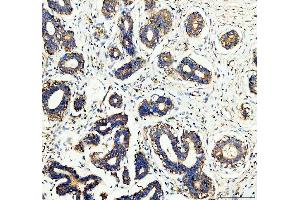 IHC analysis of WDR1 using anti-WDR1 antibody (ABIN4886763). (WDR1 抗体  (C-Term))
