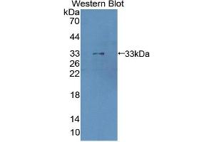 Western blot analysis of the recombinant protein. (Cathepsin Z 抗体  (AA 34-291))