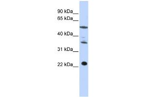 WB Suggested Anti-CENPM Antibody Titration:  0. (CENPM 抗体  (Middle Region))