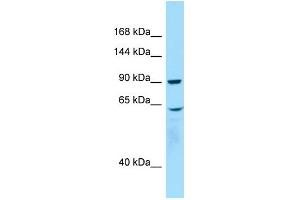 WB Suggested Anti-WHAMM Antibody Titration: 1. (WHAMM 抗体  (C-Term))