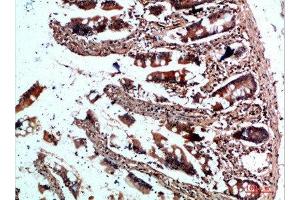 Immunohistochemistry (IHC) image for anti-Cytoplasmic FMR1 Interacting Protein 2 (CYFIP2) (AA 1171-1220) antibody (ABIN7180298)
