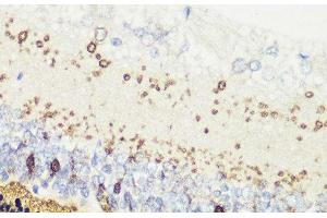Immunohistochemistry of paraffin-embedded Rat retina using RCVRN Polyclonal Antibody at dilution of 1:200 (40x lens). (Recoverin 抗体)