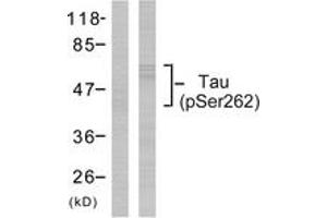 Western Blotting (WB) image for anti-Microtubule-Associated Protein tau (MAPT) (pSer262) antibody (ABIN2888545) (MAPT 抗体  (pSer262))