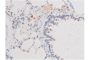 Immunohistochemistry (IHC) image for anti-Signal Transducer and Activator of Transcription 1, 91kDa (STAT1) (pSer727) antibody (ABIN6256410)