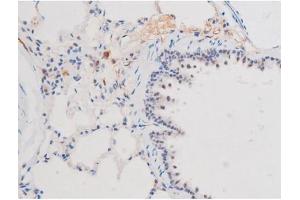 ABIN6267508 at 1/200 staining Rat lung tissue sections by IHC-P. (STAT1 抗体  (pSer727))