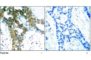 Image no. 1 for anti-P21-Activated Kinase 1 (PAK1) (Thr423) antibody (ABIN197378)