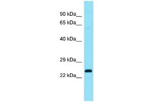 Host: Rabbit Target Name: C4orf45 Sample Type: Fetal Lung lysates Antibody Dilution: 1. (C4ORF45 抗体  (C-Term))
