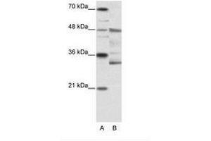 Image no. 1 for anti-Forkhead Box N2 (FOXN2) (N-Term) antibody (ABIN6736146) (FOXN2 抗体  (N-Term))