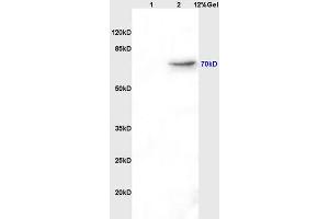 Lane 1: rat brain lysates Lane 2: rat kidney lysates probed with Mouse Anti-AFP(A2) Monoclonal Antibody, Unconjugated (ABIN722901) at 1:200 in 4 °C. (alpha Fetoprotein 抗体)