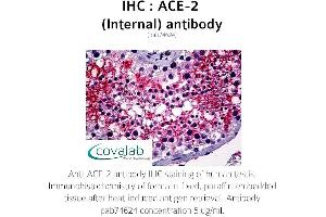 Image no. 1 for anti-Angiotensin I Converting Enzyme 2 (ACE2) (Internal Region) antibody (ABIN5693460) (ACE2 抗体  (Internal Region))