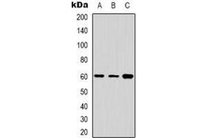 Western Blotting (WB) image for anti-Cytochrome P450, Family 24, Subfamily A, Polypeptide 1 (CYP24A1) (C-Term) antibody (ABIN7303146)