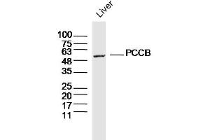 Mouse liver lysates probed with PCCB Polyclonal Antibody, Unconjugated  at 1:300 dilution and 4˚C overnight incubation. (PCCB 抗体  (AA 321-420))