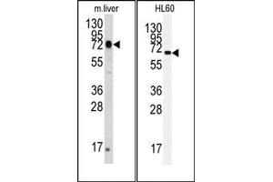Image no. 1 for anti-Heat Shock 70kDa Protein 5 (Glucose-Regulated Protein, 78kDa) (HSPA5) antibody (ABIN356850) (GRP78 抗体)