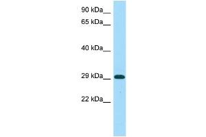 WB Suggested Anti-MICU1 Antibody Titration: 1. (MICU1 抗体  (C-Term))