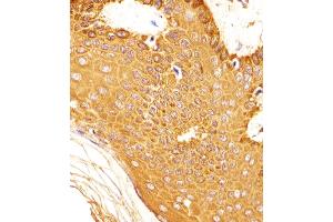(ABIN6242763 and ABIN6577904) staining SNCA in Human skin tissue sections by Immunohistochemistry (IHC-P - paraformaldehyde-fixed, paraffin-embedded sections).