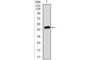 Western Blotting (WB) image for anti-RAB4A, Member RAS Oncogene Family (RAB4A) antibody (ABIN1108812) (Rab4 抗体)