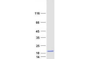 Western Blotting (WB) image for Hemoglobin, gamma G (HBG2) protein (Myc-DYKDDDDK Tag) (ABIN2722611)