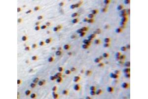 Used in DAB staining on fromalin fixed paraffin-embedded Brain tissue (CIDEA 抗体  (AA 1-219))