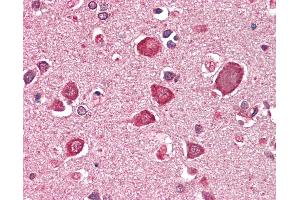 Anti-GABRA6 antibody IHC staining of human brain, cortex. (GABRA6 抗体  (AA 15-26))