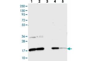 Western blot analysis of Lane 1: RT-4, Lane 2: U-251 MG, Lane 3: Human Plasma, Lane 4: Liver, Lane 5: Tonsil with CNPY2 polyclonal antibody . (CNPY2/MSAP 抗体)