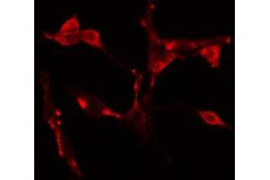 ABIN6274617 staining Hela cells by IF/ICC. (CDCA7 抗体  (Internal Region))
