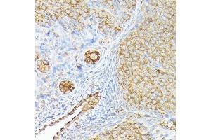 Immunohistochemistry (IHC) image for anti-Chemokine (C-X3-C Motif) Ligand 1 (CX3CL1) (AA 365-397) antibody (ABIN6139265)