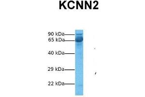 Western Blotting (WB) image for anti-Potassium Intermediate/small Conductance Calcium-Activated Channel, Subfamily N, Member 2 (KCNN2) (C-Term) antibody (ABIN2776144)