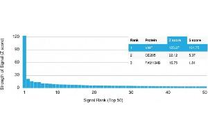 Analysis of Protein Array containing >19,000 full-length human proteins using vWF Mouse Monoclonal Antibody (VWF/1767) Z- and S- Score: The Z-score represents the strength of a signal that a monoclonal antibody (Monoclonal Antibody) (in combination with a fluorescently-tagged anti-IgG secondary antibody) produces when binding to a particular protein on the HuProtTM array. (VWF 抗体  (AA 1815-1939))