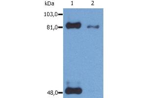 Western Blotting analysis (reducing conditions) of phosphorylated STAT1 (Ser727) in IFN-γ treated HeLa human cervix carcinoma cell line using anti-Phospho STAT1 (PSM1).