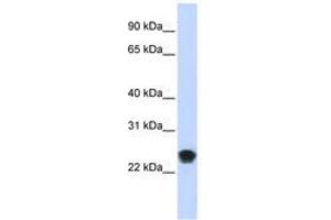 Image no. 1 for anti-FK506 Binding Protein 11, 19 KDa (FKBP11) (AA 35-84) antibody (ABIN6740999) (FKBP11 抗体  (AA 35-84))