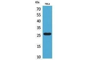 Western Blotting (WB) image for anti-CD302 (CD302) (Internal Region) antibody (ABIN3178489) (DCL1 抗体  (Internal Region))